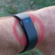 Illustration for article titled Are We Doomed to Get Rashes from Our Fitness Trackers?